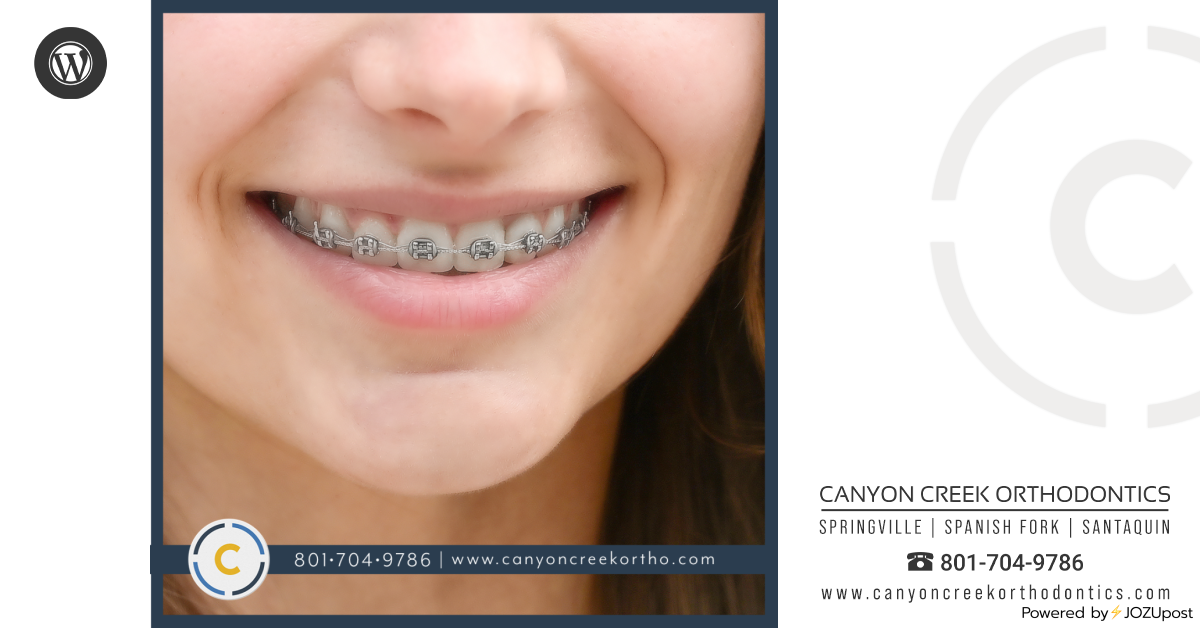 News & Info – Canyon Creek Orthodontics
